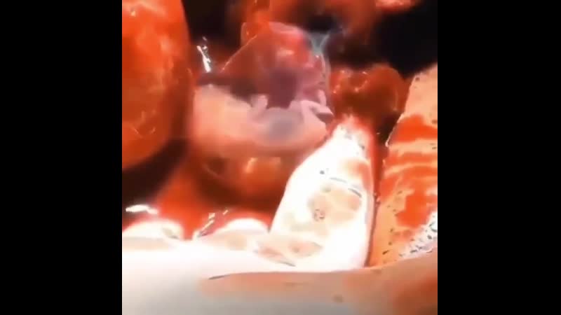 video внематочная беременность sex
