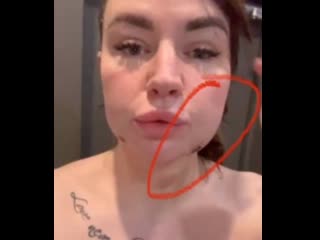 video саша черно рыдает после пластической операции нос в одну сторону а губы в другую sex