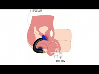 video пальцевое исследование простаты sex