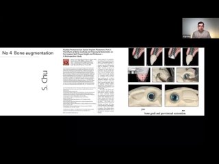 video предсказуемые эстетические результаты в различных исходных ситуациях при имплантации sex