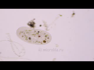 video инфузория frontonia красивое облегчение sex