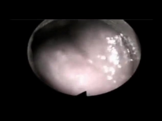 video pornhub vaginal cam filmed from the inside during sex sex