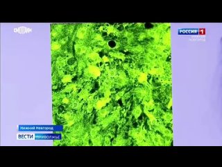 video ученые нижегородского университета имени лобачевского разрабатывают способ защитить человека от повторного инсульта sex