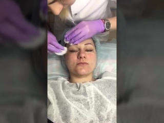 video завершение комбинированной чистки лица sex