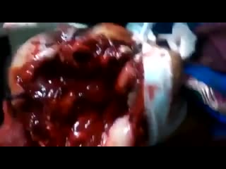 video бразильянка молодые после того как в ее лицо запустили фейерверк sex