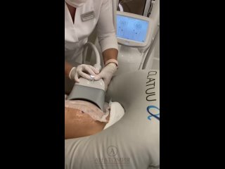 video безоперационная липосакция на clatuu sex