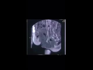 video секс во время мрт необычный эксперимент проведенный 20 лет назад доктором тони деламотом опубликован в bmj sex