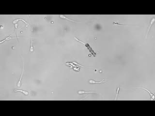 video нанобот производит искусственное оплодотворение яйцеклетки sex