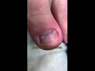 video видео от pedicure journal идеи педикюра подология sex