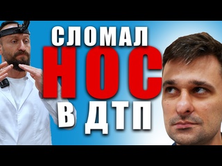video авария унесла нос а мы его вернули на место риносептопластика в махачкале ринопластика sex