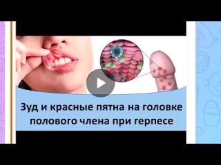 video зуд и красные пятна на голое полового члена при герпесе sex