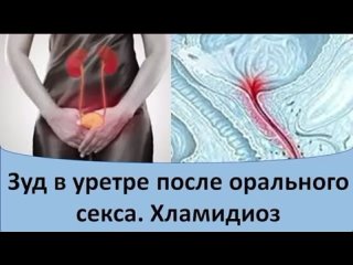 video зуд в уретре после орального секса хламидиоз sex