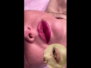 video видео от врач косметолог лина балашиха sex