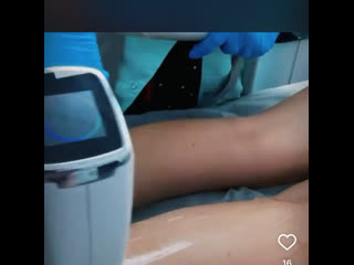 video видео от г арзамас лазерная эпиляция электроэпиляция ems sex