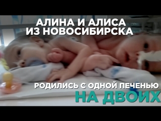 video алина и алиса сиамские близнецы из новосибирска sex