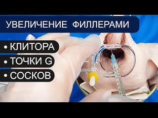 video увеличение клитора точки g сосков филлерами контурная пластика гиалуроновая кислота sex
