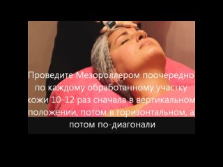 video применение мезороллера sex
