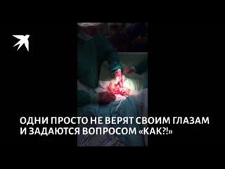 video шок контент врачи петербурга достали из пациента гигантское дилдо и выложили видео в сеть sex