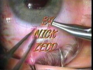 video ненормальный коллекция фильмов ника зедда abnormal the sinema of nick zedd 1980 2001 часть 1 sex