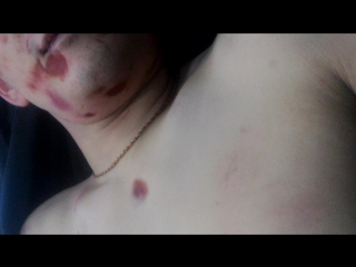 video 18 осмотр трупа забитого насмерть парня 28 и лет служителями закона sex