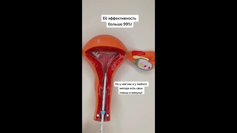 video постаноа внутриматочной спирали sex