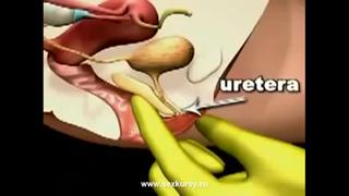 video как пробудить точку g сквирт sex