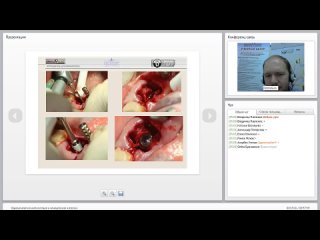 video 2014 03 18 одномоментная имплантация и немедленная нагрузка 0001 sex