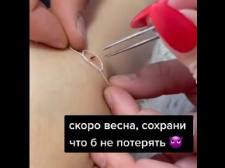 video вот так надо вытаскивать клещей актуальная информация sex