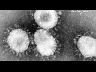 video нераскрытые тайны происхождение вирусов 2014 документальное кино sex
