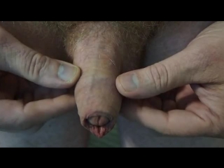 video the foreskin and frenulum in sex