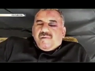 video видео с выжившим летчиком сбитого су 22 ввс сирии появилось в интернете sex