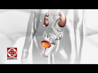 video цистит у женщин профилактика и лечение цистита sex