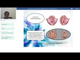 video эстетическая гинекология лабиопластика гименопластика sex