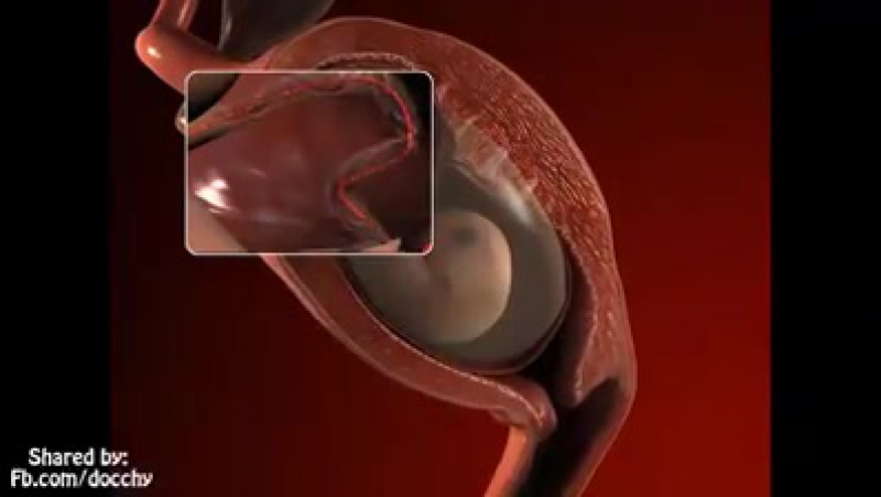 video оплодотворение беременность sex