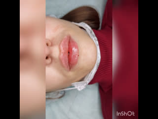 video видео от косметология массаж лазерная эпиляция донецк sex