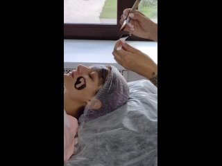 video лазерный карбоновый пилинг sex