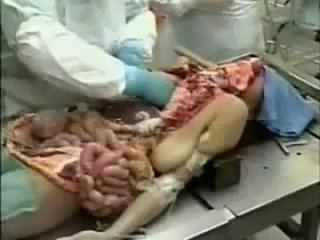 video вскрытие человека в морге sex