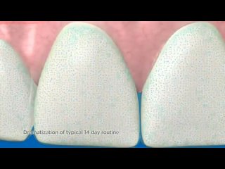 video инструкция для применения отбеливающих пластин crest 3d white in english sex