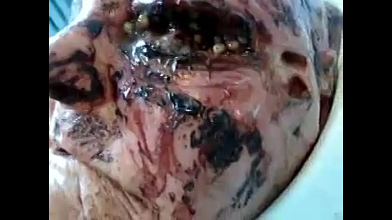 video уральски живую бомжиху жрут черви sex