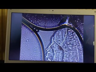 video в вакцине pfizer обнаружены неизвестные живые организмы sex
