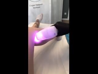 video эпиляция красивых ножек sex