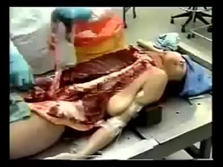 video не для всех вскрытие трупа на суд мед экспертизе за границейдля людей с крепкой психикой sex