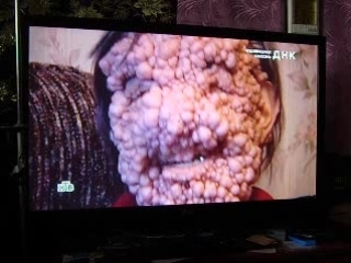video чел покрылся пупырышками гены sex